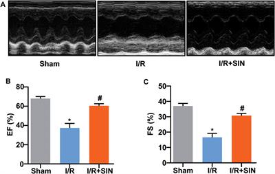 Sinomenine Confers Protection Against Myocardial Ischemia Reperfusion Injury by Preventing Oxidative Stress, Cellular Apoptosis, and Inflammation